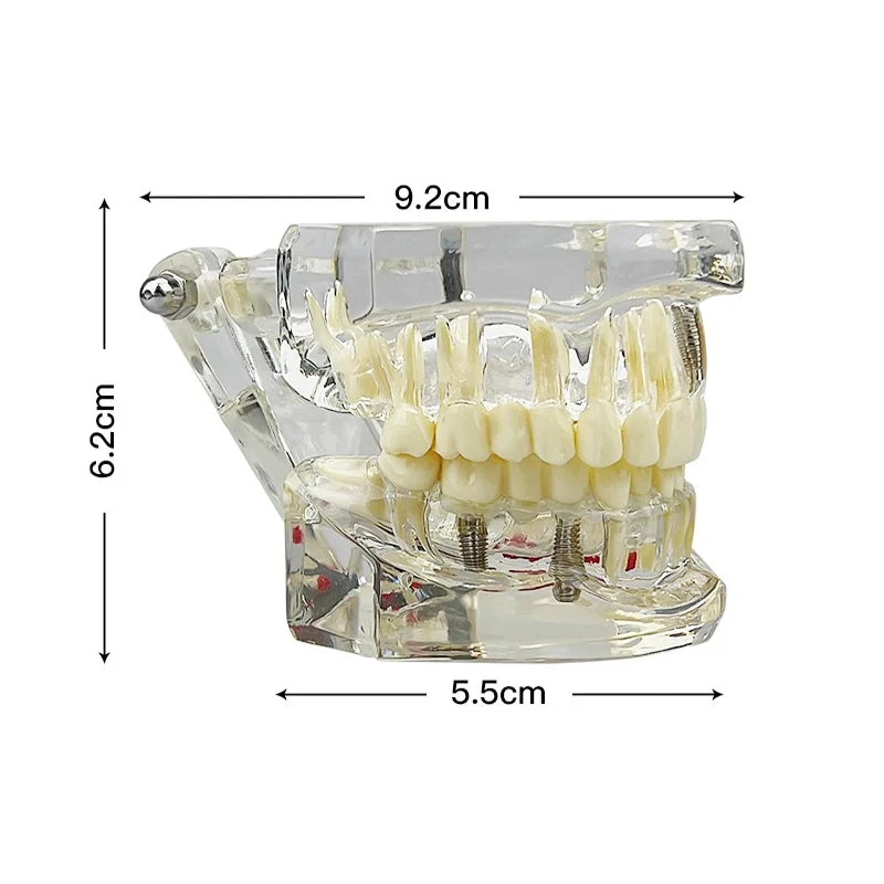 VVDental Teeth Repair Model Disease Teeth Model for Dentist Student Practice Training Studying Oral Medical Dentistry Tools