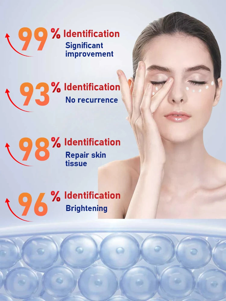 2026 New Upgraded Bestselling Eye Care Tool - Eye Revitalizing Ointment (Free Shipping)