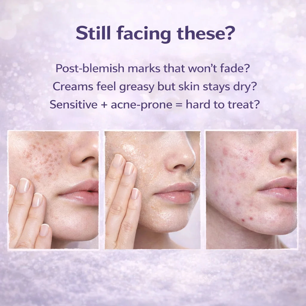 Centella Face Cream Deep Hydration Renew PDRN Cream 50ml, Soothes and Firms The Skin,Moisturizing PDRN Cream for Women