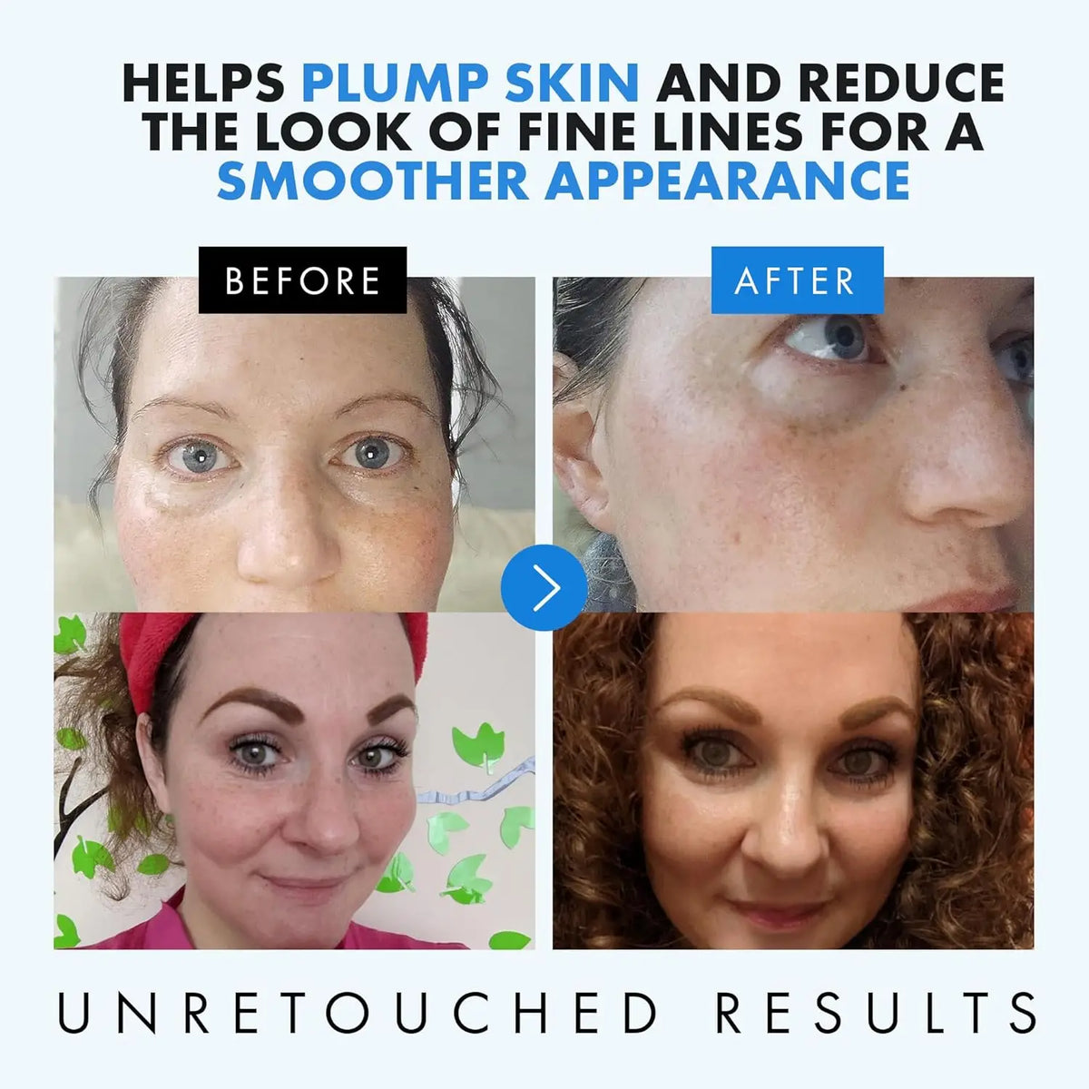 Hydrating Hyaluronic Acid Facial Serum Deep Moisturizing Facial Skin Essence & Plumping Formula for Radiant & Smoother Skin