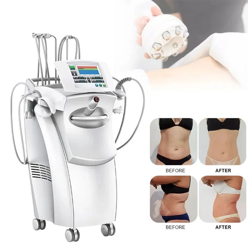 Professional Vacuum Slimming machine Cellulite Removal wrinkle removal Lose weight Vacuum Fades Pregnancy Marks