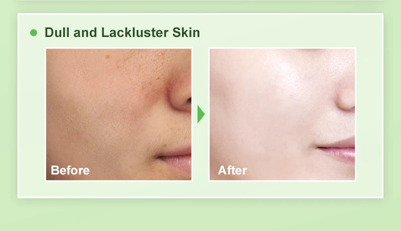 AUQUEST Niacinamide Face Cream Whitening  Moisturizing Hyaluronic Acid Smoothing Brightening Facial Cream Skin Care