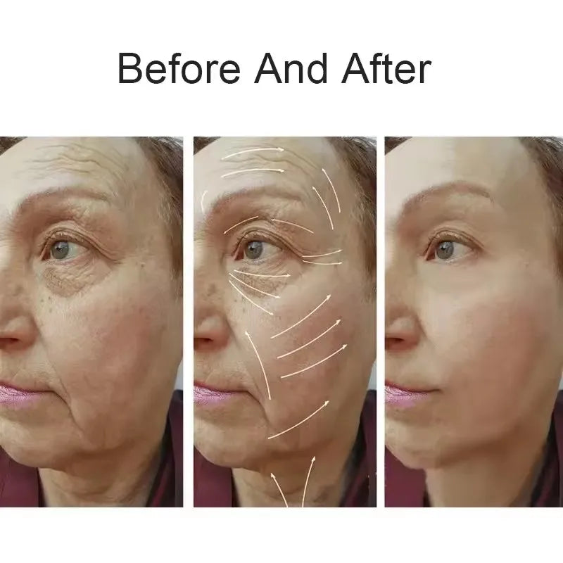 New Facial Lifting Massager Facial Eye Care Home Use Wrinkle Fine Line Removal Skin Rejuvenation Machine Beauty Device