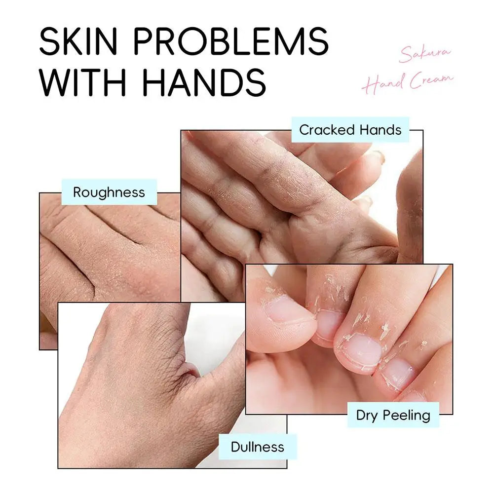 Sakura Hand Cream Whitening Wrinkle Removal Anti-crack Moisturizing Skin Care Cracked Repair Products Repair Hand Gream