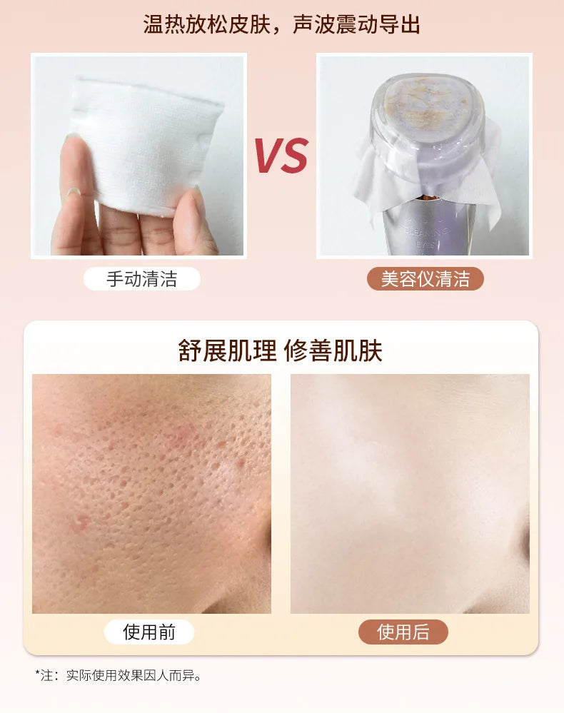 Electric Eye Machine Face Lifting Beauty Equipment Equipment Wrinkle Removal Dark Circles Face Lift Ems Eye Massager Beauty