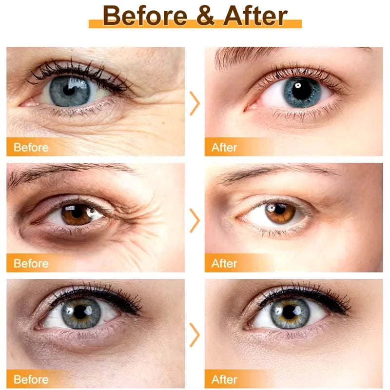 Instant Eye Bag Removal Rolling Beads Massage Serum Retinol Anti-Wrinkle Firm Skin Anti Dark Circle Puffiness Brighten Eye Care