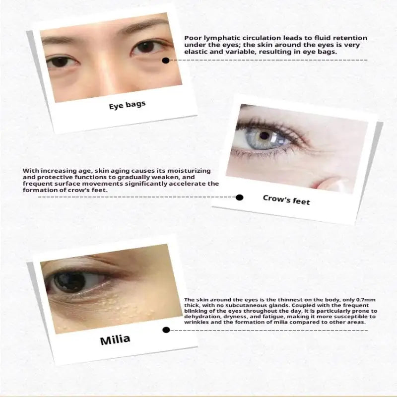 4 In 1 Electric Facial Massager Micro Vibration Eye Beauty Instrument For Relax Eye Dark Circles Eye Bags Puffiness Eye Massage
