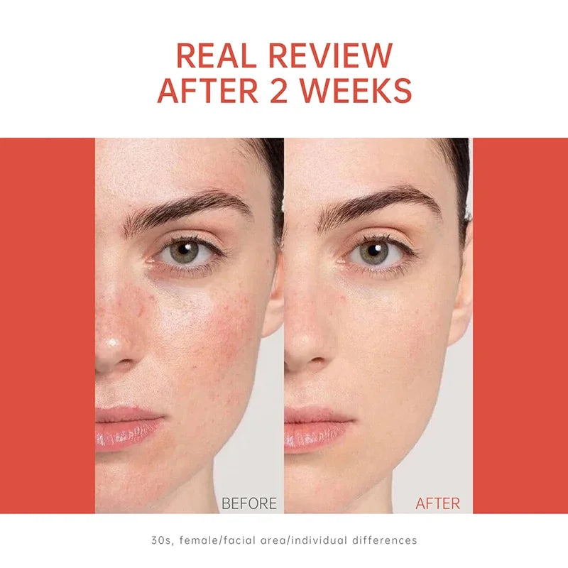 PDRN Serum Ampoules 30ml Renew Skin Daily Skincare Deeply Repair Multi-effect Skin Barrier Strengthening Firming Facial Serum