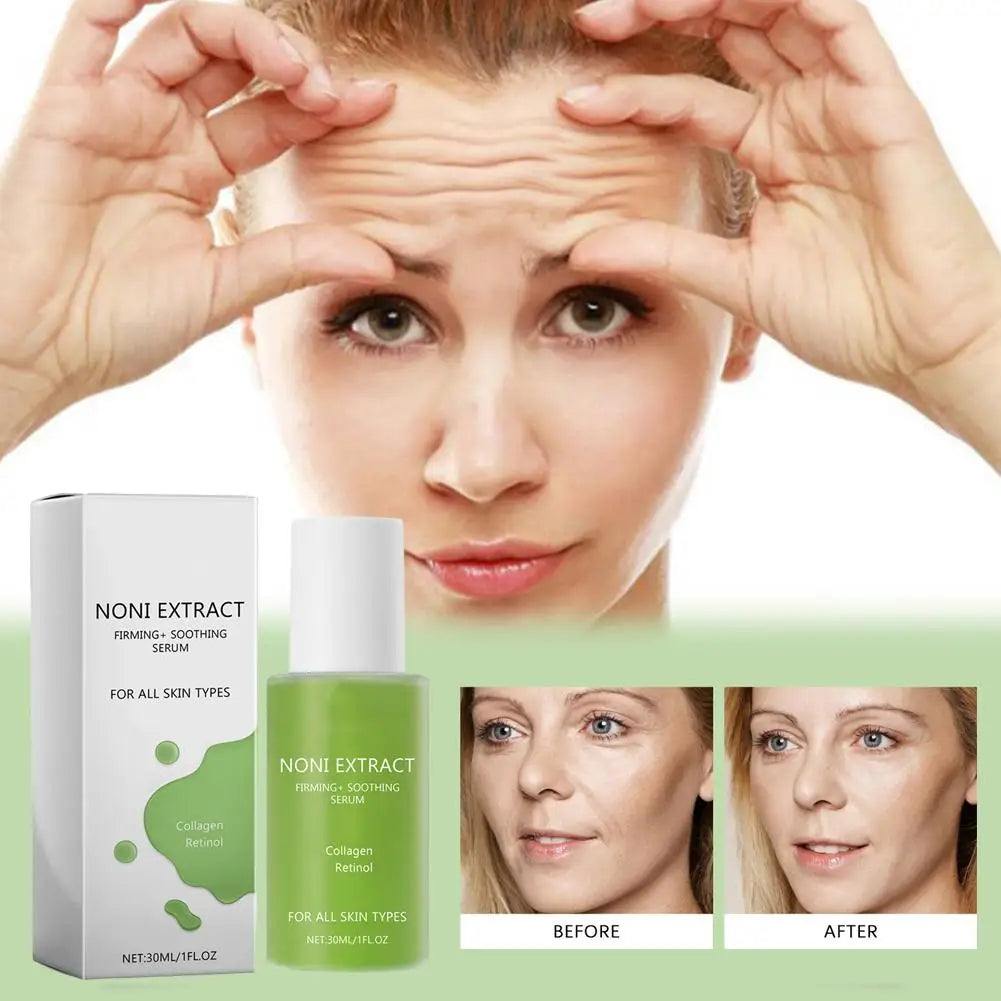 30ml Noni Fruit Face Serum Hydrating Moisturizing Fade Fine Lines Collagen Retinol Serum for Firming Anti-Aging Skincare ﻿