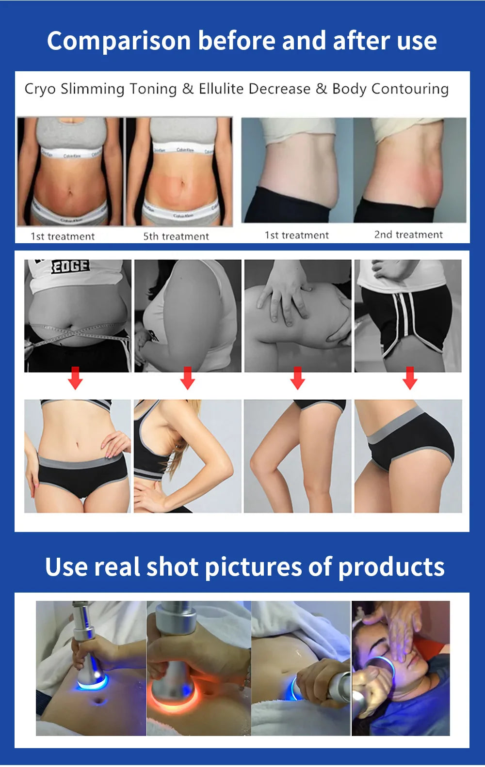 Professional Cryoskin Slimming Machine 2 Round Heads 2 Freezing Plates Skin Tightening Cellulite Removal Device
