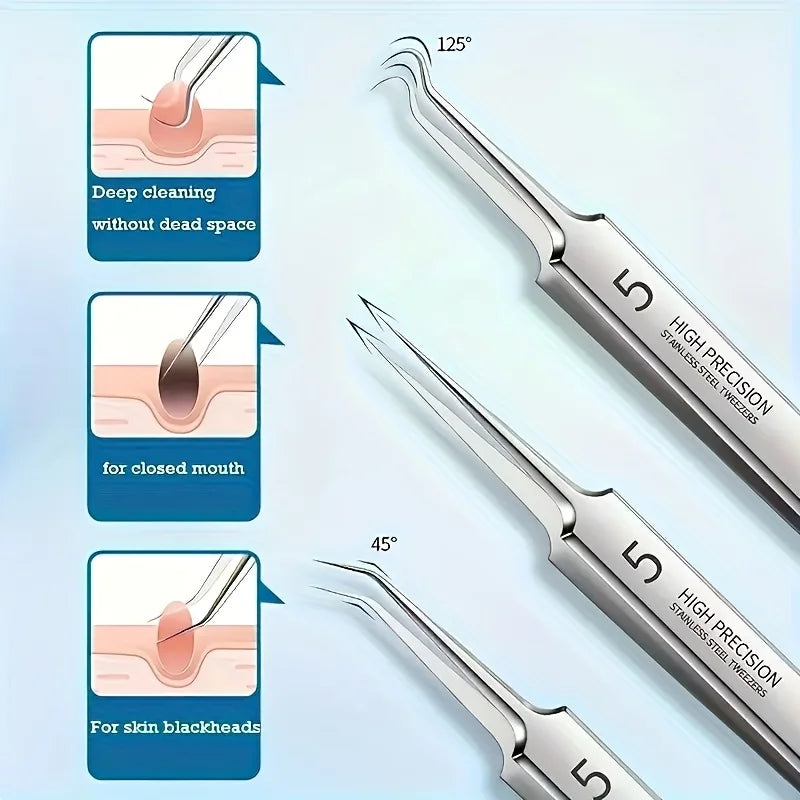 8-Piece Blackhead Remover Kit – Stainless Steel Blemish & Acne Extraction Tools – Professional Pimple Popper Set for All Skin