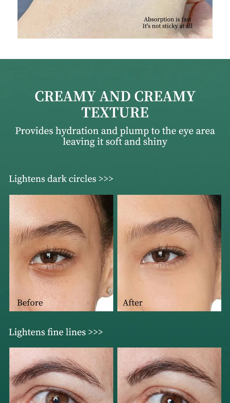 Retinol A Ester Elastic Moisturizing Firming Eye Cream Fading Fine Lines Dark Circles 30g