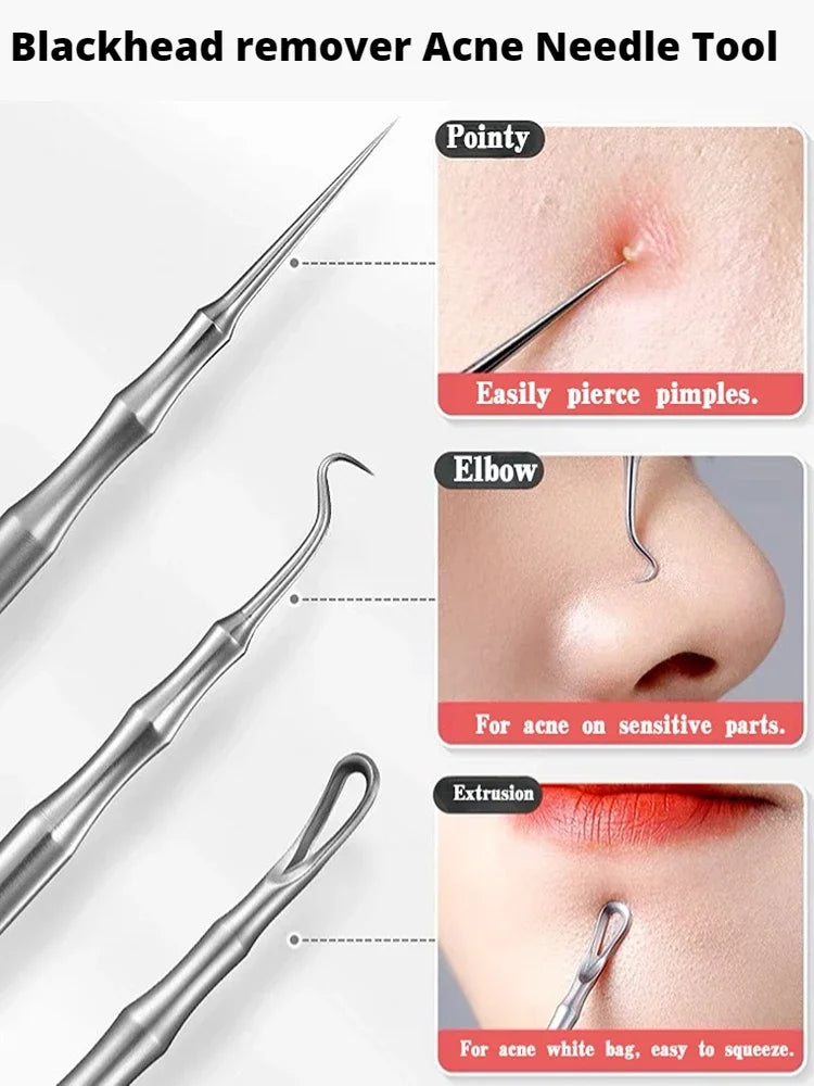 New Acne Needle Kit, Remove Blackheads, Pimples & Closed Comedones