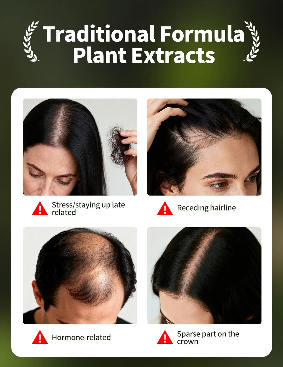 Natural Hair Growth Set Usman Grass Shampoo Soap Herbal Hair Regrowth Oil Anti Hair Loss Serum Scalp Care Spray for Men Women