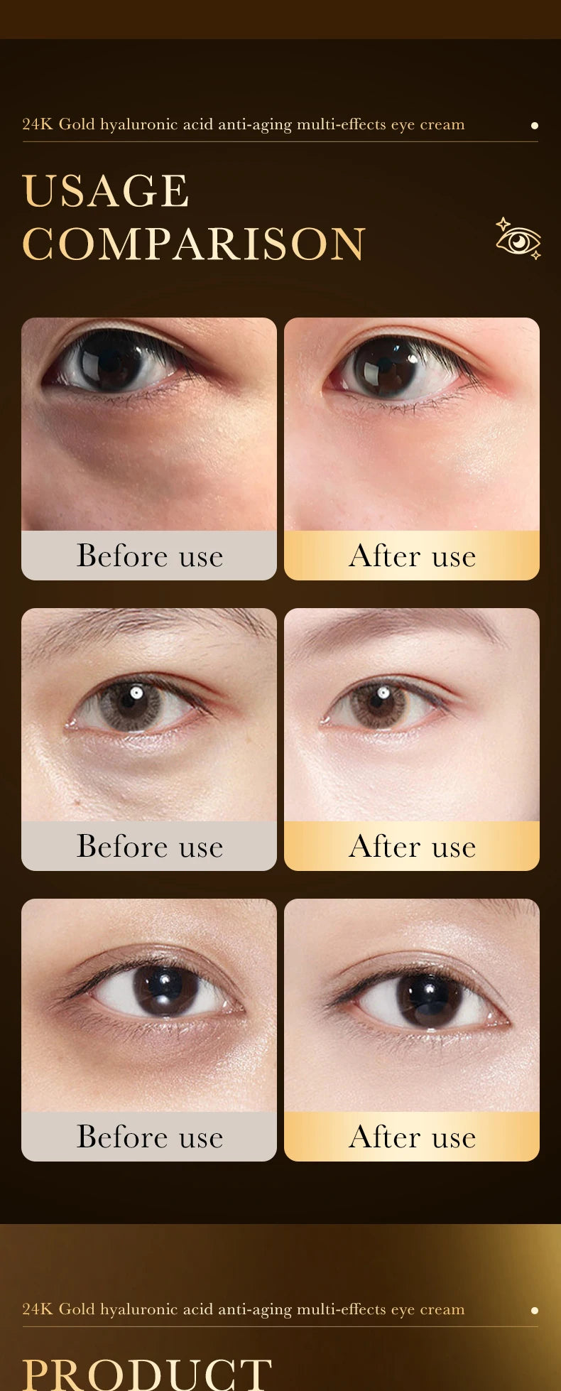 24K hyaluronic acid eye cream, nourishing, improving dark circles and eye wrinkles, anti-aging eye cream essence