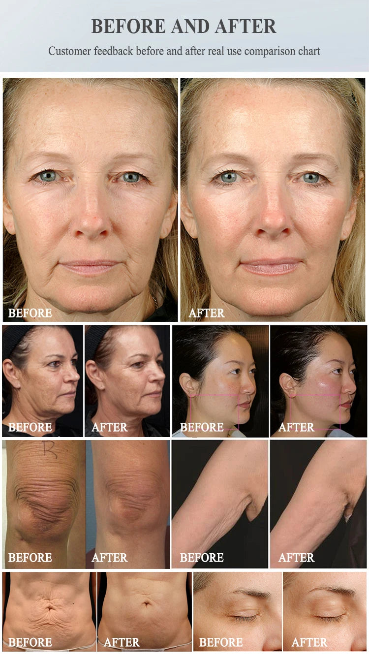 NEW Ems RF Facial Electrostimulation Face Lifting Machine 6 Handles Sculpt Face Pads Massager Device Anti Aging Wrinkles Removal
