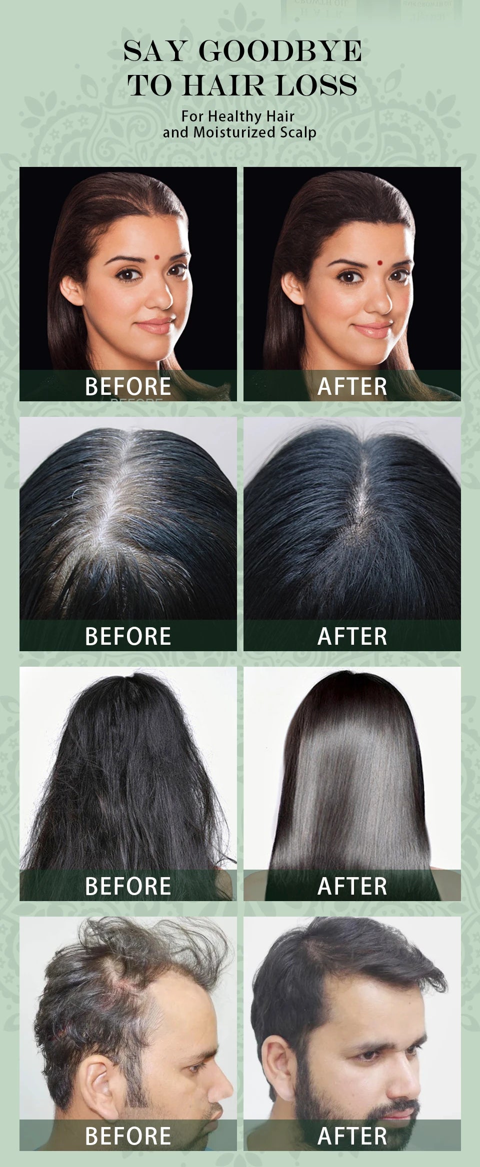 Hair Growth Oil Set Rosemary Hair Growth Oil Natural Herbal Hair Care Shampoo India Ayurvedic Anti Hair Loss Hair Regrowth Serum