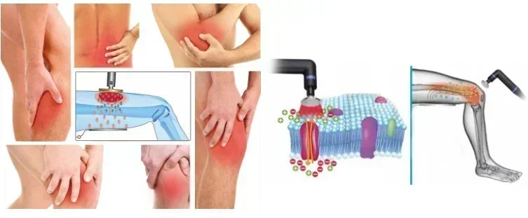 2026 new CET RET Thermal System Indiba Tecar Intelligent Diathermy Machine Physiotherapy 448khz ER45 Body Shaper