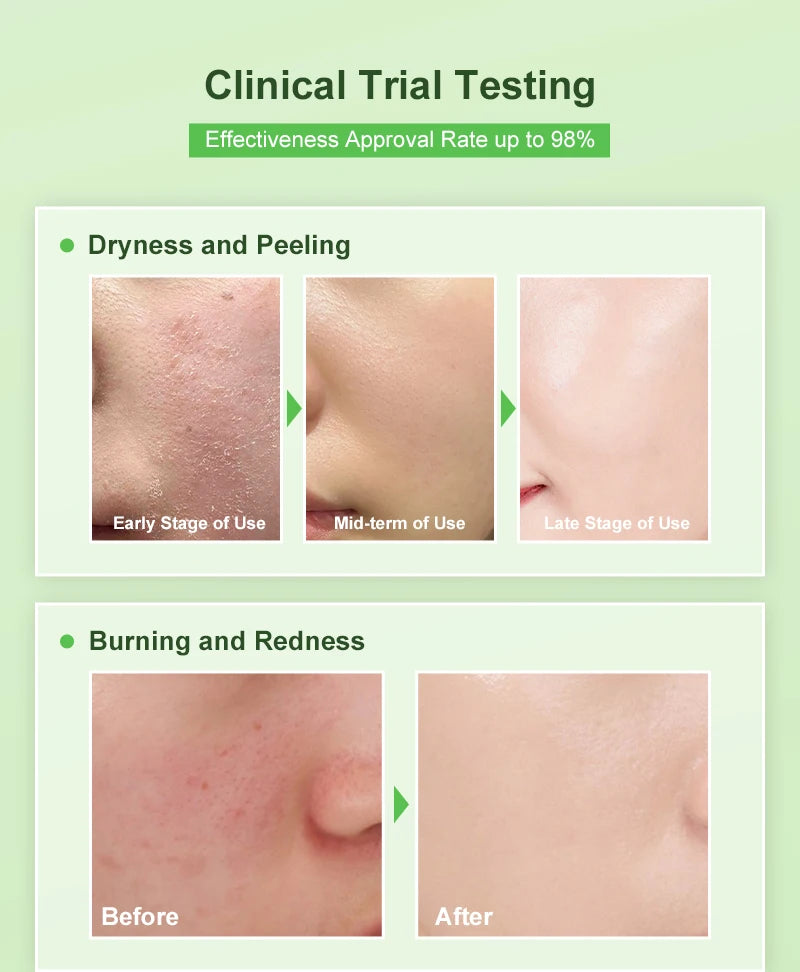 AUQUEST Niacinamide Face Cream Whitening  Moisturizing Hyaluronic Acid Smoothing Brightening Facial Cream Skin Care