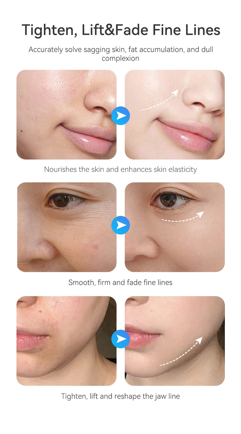 7 In 1 EMS Face Body Sculpting Massager With 3-Level Suction Strength Adjustment Function Used For Face Skin Tightening