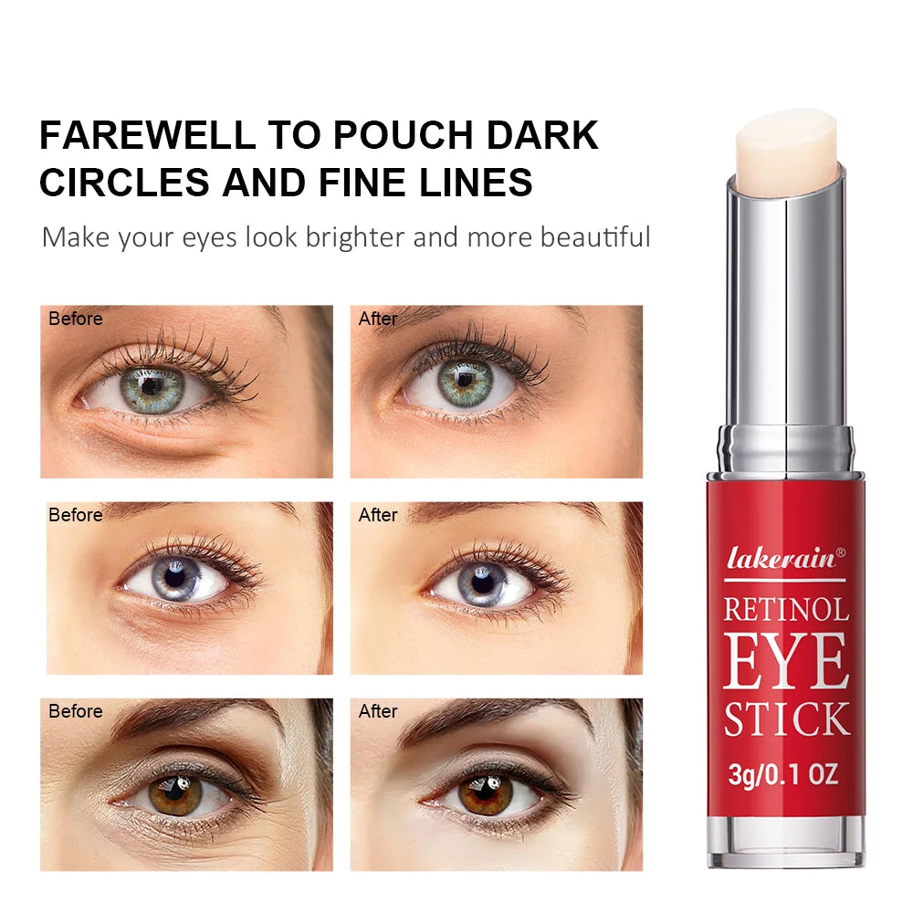 HOT Anti-Wrinkle Eye Cream Retinol Remove Eye Bags Dark Circles Anti Aging Lifting Whitening Moisturizing Brighten Eye Primer