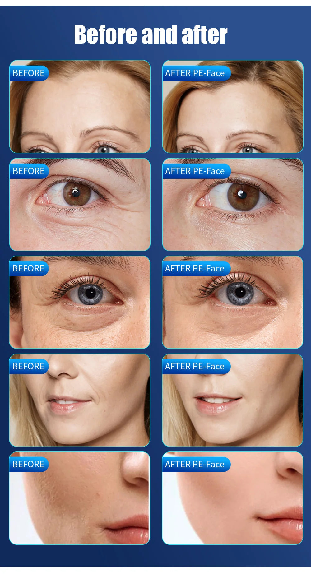 Professional EMS Face Lifting Machine Face Sculpting EMSWrinkle Removal RF Skin Tightening Stimulato