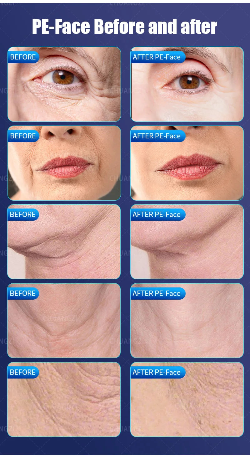 Ems RF Facial Electrostimulation Face Lifting Machine  6 Handles Sculpt Face Pads Massager Device Anti Aging Wrinkles Removal