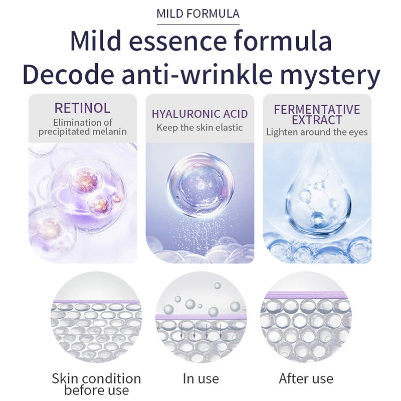 Improve Wrinkle Dark Circle Eye Cream Roller Massager Firming Moisturizing Eye Bags Hyaluronic Acid Eye Skin Care Products