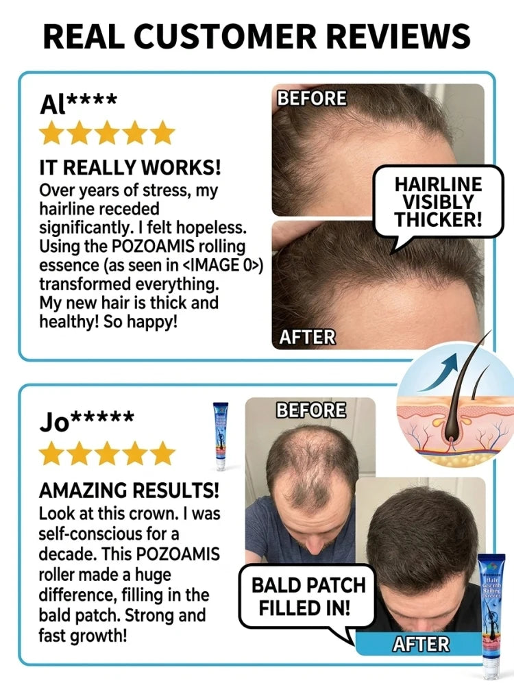 Portable Roll-on Scalp Massage Essence, Gentle Scalp Nourishing Serum, Relieve Uncomfortable Scalp, Hydrate Scalp Skin, Lightweight Liquid for At-home Scalp Care & Massage