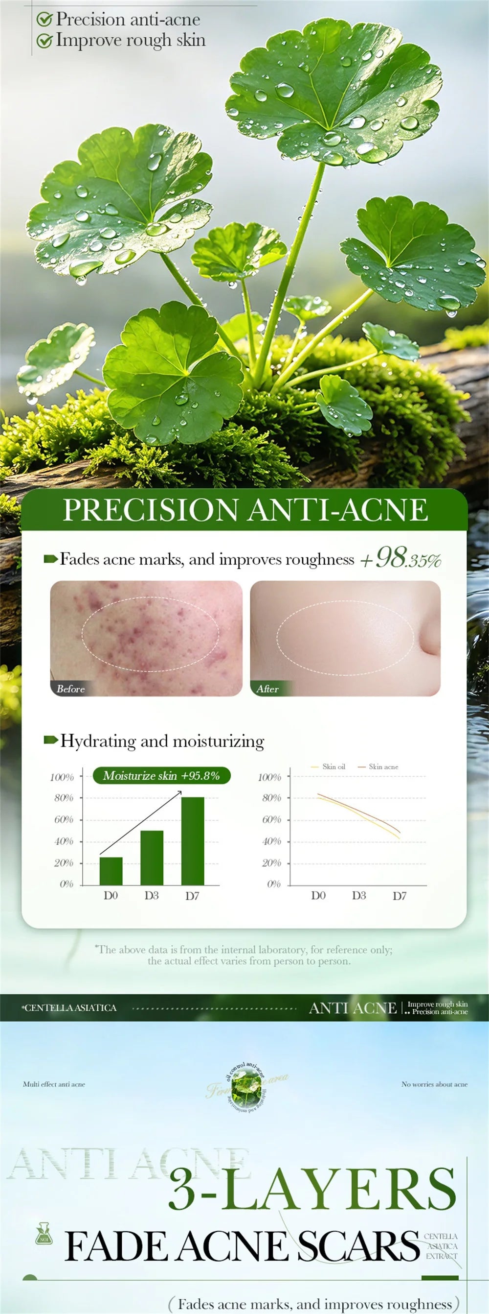 Salicylic Acid Acne Treatment Face Cream Repair Pimple Spots Deep Cleaning Pore Anti-acne Scar Oil Control Moisturizer Skin Care