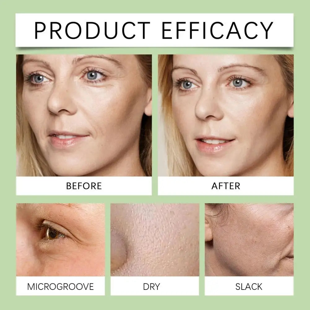 30ml Noni Fruit Face Serum Hydrating Moisturizing Fade Fine Lines Collagen Retinol Serum for Firming Anti-Aging Skincare ﻿