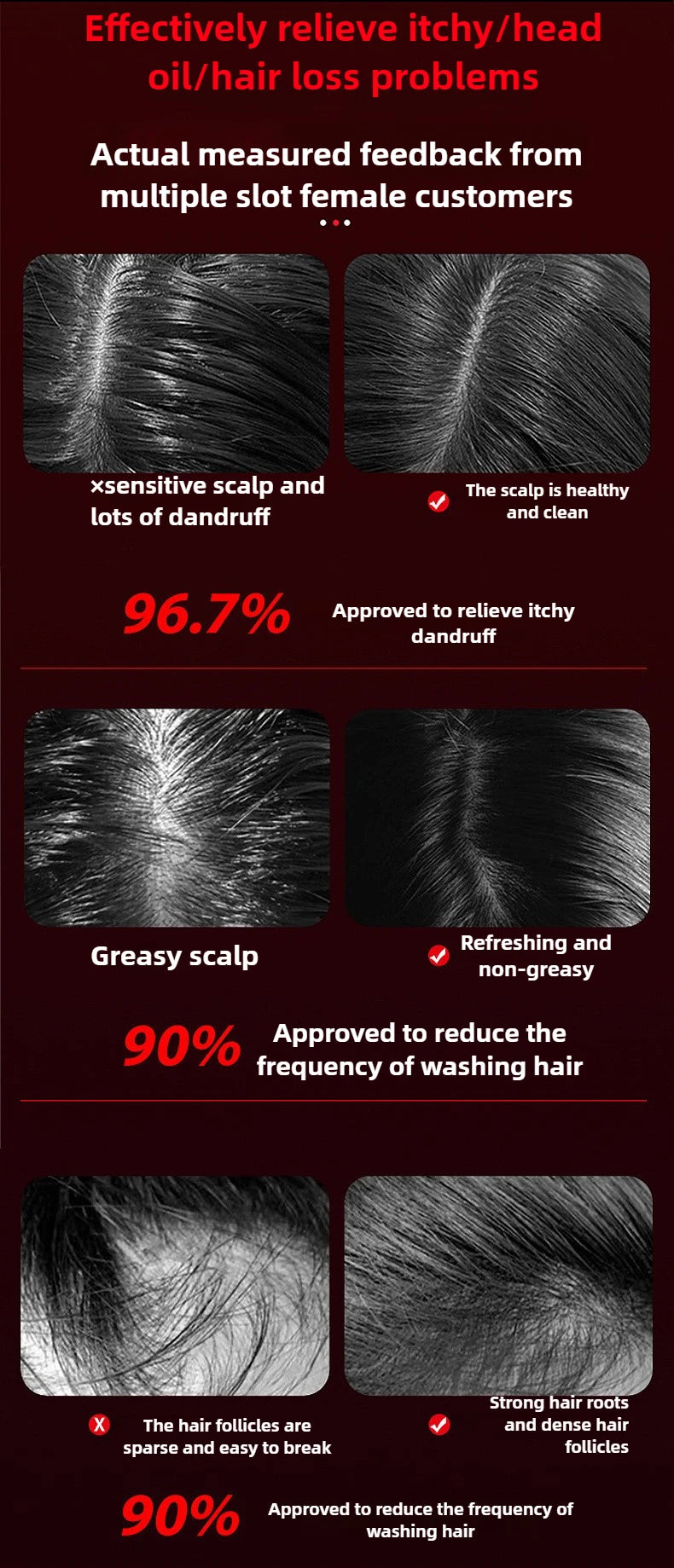 XYT-0806 Red Light Electric Massage Comb Kneading Living Hair Scalp Medicine Device Healthy Hair Guide Liquid Growth Instrument