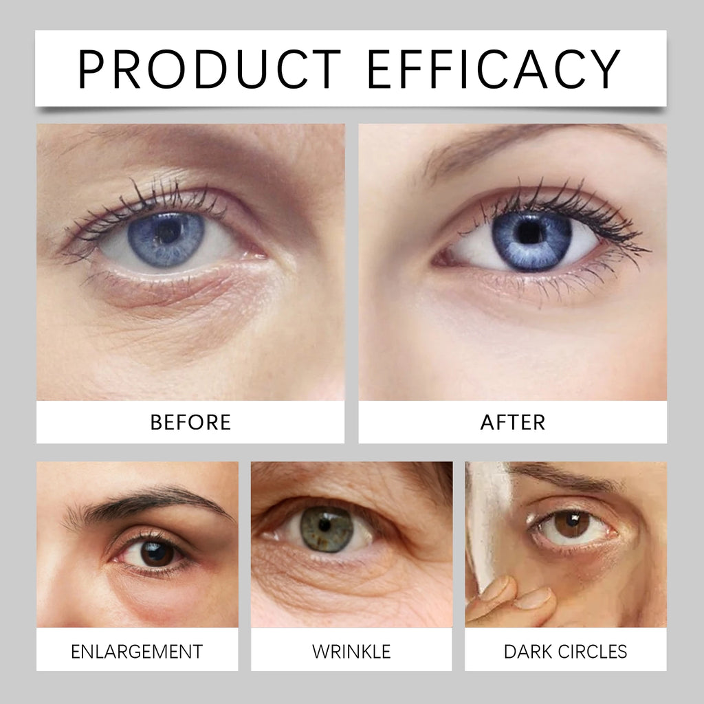 HOYGI Retinol Eye Cream Firming Skin Around Eyes Improve Eye Bags Smooth Fine Lines Reduce Dark Circles Nourishing Balm Stick