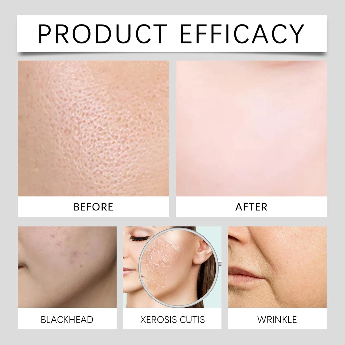 Hyaluronic Acid Facial Kit Hydrating Serum Roller Delicate Firming Facial Skin Smoothing Nourishing Skin Daily Care Essence Set