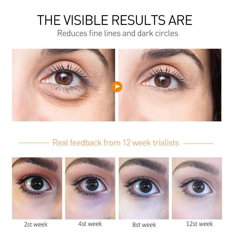 Eye Anti-Wrinkle Cream Fades Fine Lines Anti Dark Circles Eye Serum Remove Eye Bag Puffiness Anti-Aging Firmness Eye Care OCHEAL