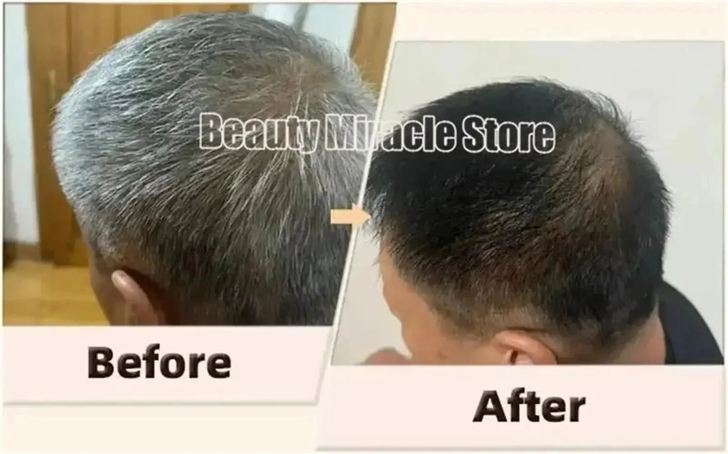 Herbal Anti-grey Hair Treatment Serum Cream White To Black Permanent Repair Natural Color Nourish Scalp Hair Care Products