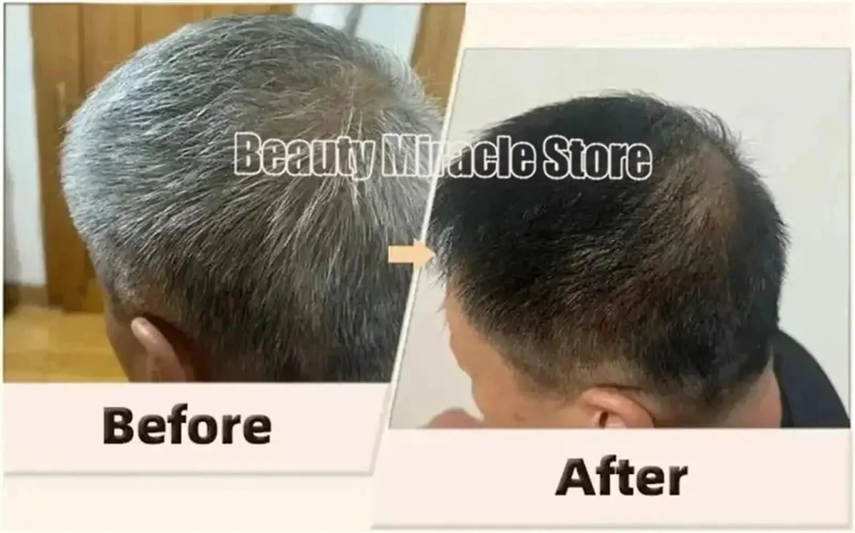Herbal Anti-grey Hair Treatment Serum Cream White To Black Permanent Repair Natural Color Nourish Scalp Hair Care Products