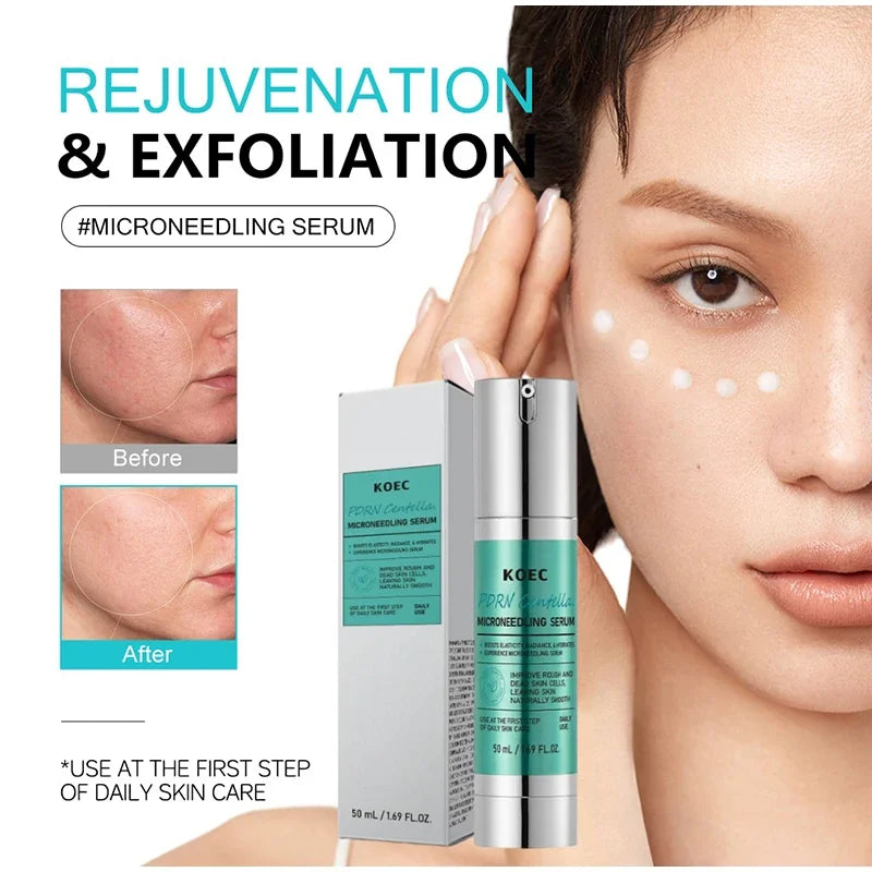 Soothing Microneedle Serum, Centella Asiatica & Propolis For Skin Barrier, Pore Care Exfoliating Korean Glass Skin Essence 50g