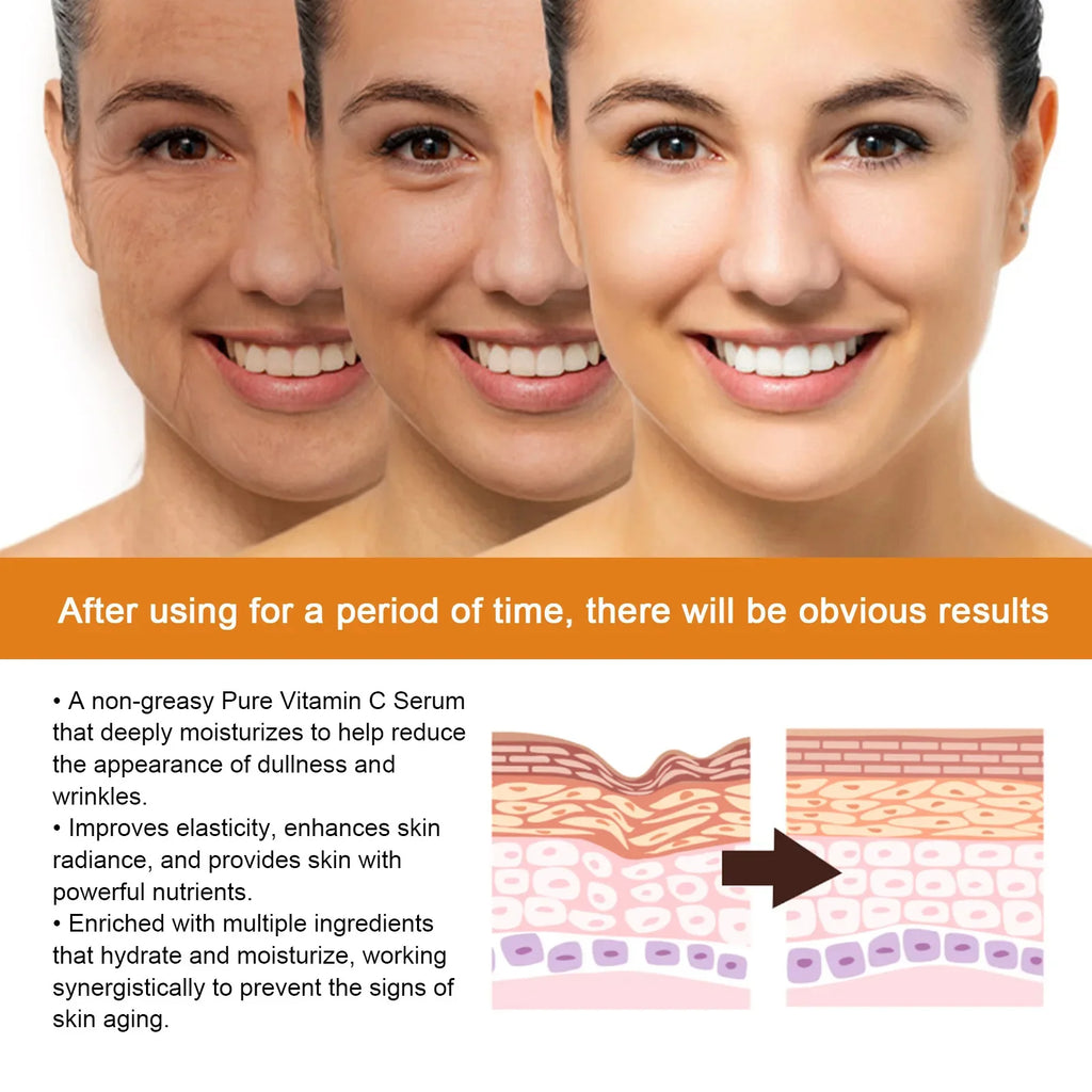 Vitamin C Whitening Serum Face Remove Dark Spots Freckles Fade Melanin Retinol Anti-wrinkle Essence Brightening Korean Skin Care