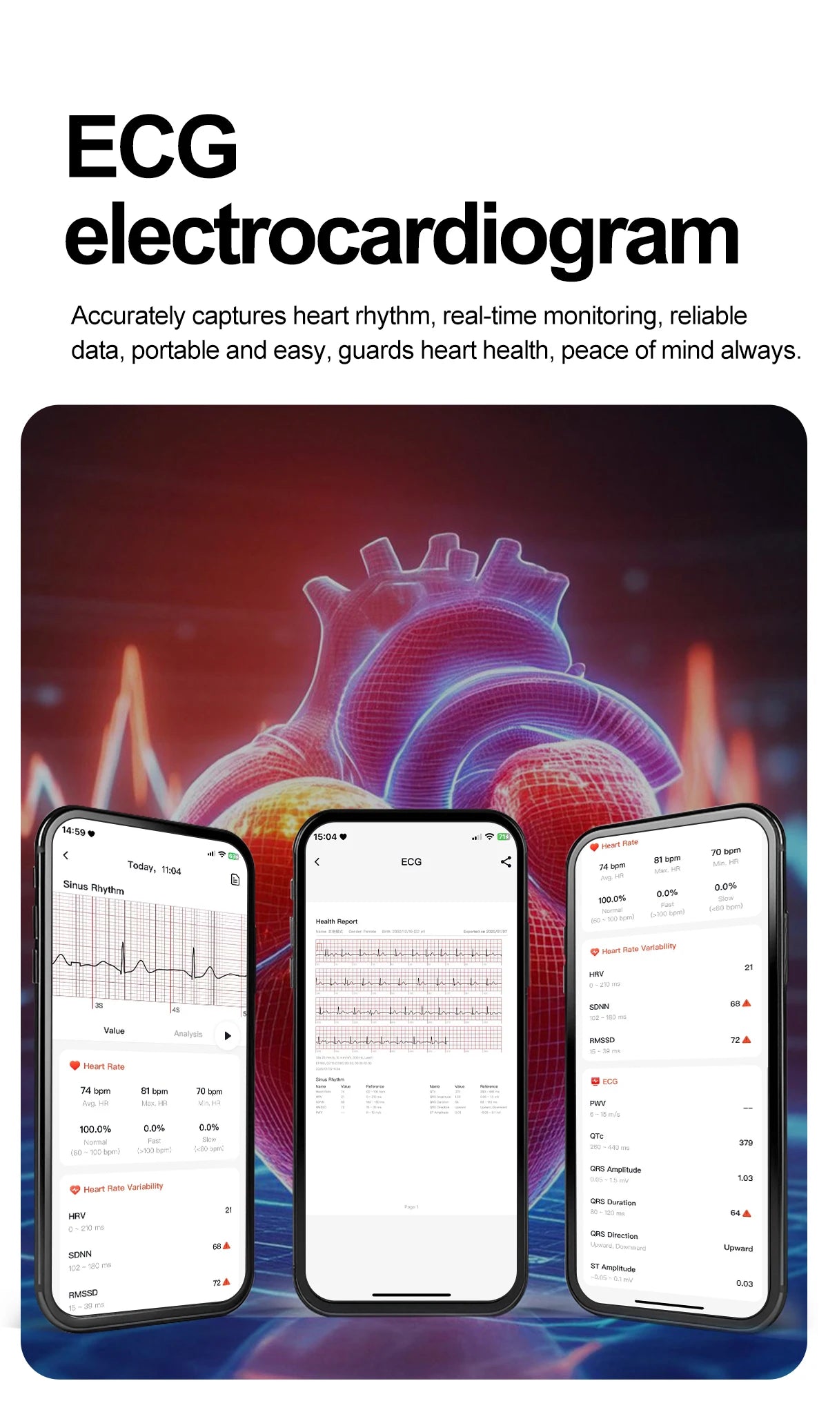 2026 New AI-Diagnosis Care Smartwatch Accurate ECG Uric Acid Lipids Blood Pressure Body Fat IP68 Waterproof Fitness Smartwatch