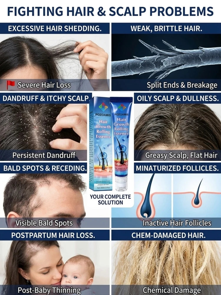 Portable Roll-on Scalp Massage Essence, Gentle Scalp Nourishing Serum, Relieve Uncomfortable Scalp, Hydrate Scalp Skin, Lightweight Liquid for At-home Scalp Care & Massage