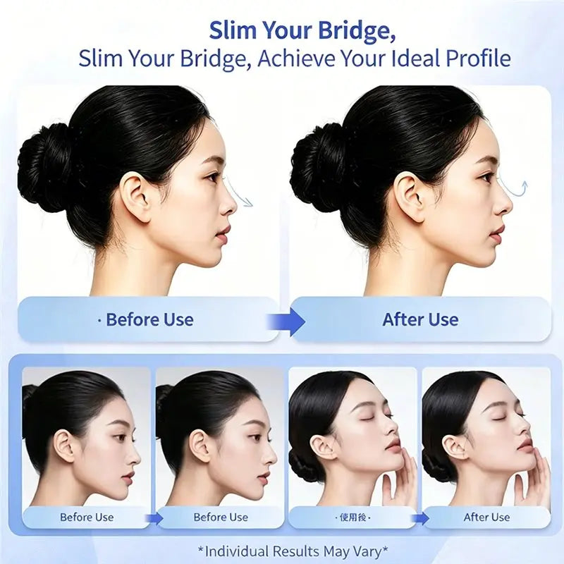 A50Q-Beauty Nose Clip Silicone Nose Shaper Machine Electric EMS Technology Lifter Clip Nose Shaper Women Daily Beauty Tool