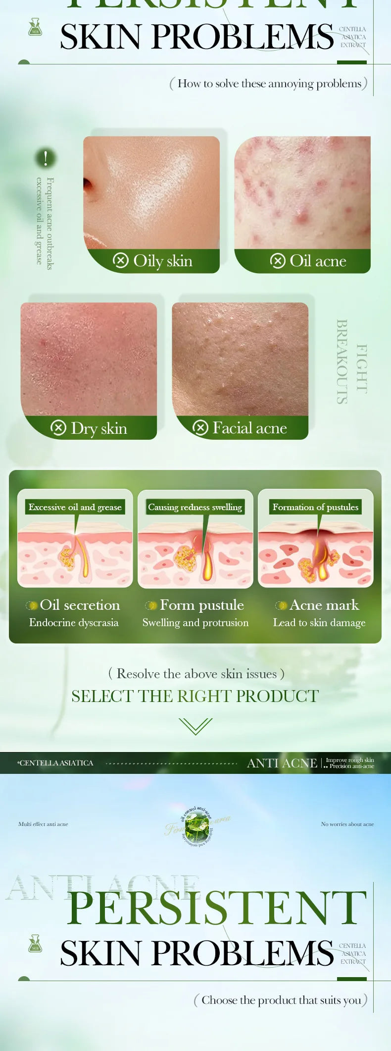 Salicylic Acid Acne Treatment Face Cream Repair Pimple Spots Deep Cleaning Pore Anti-acne Scar Oil Control Moisturizer Skin Care