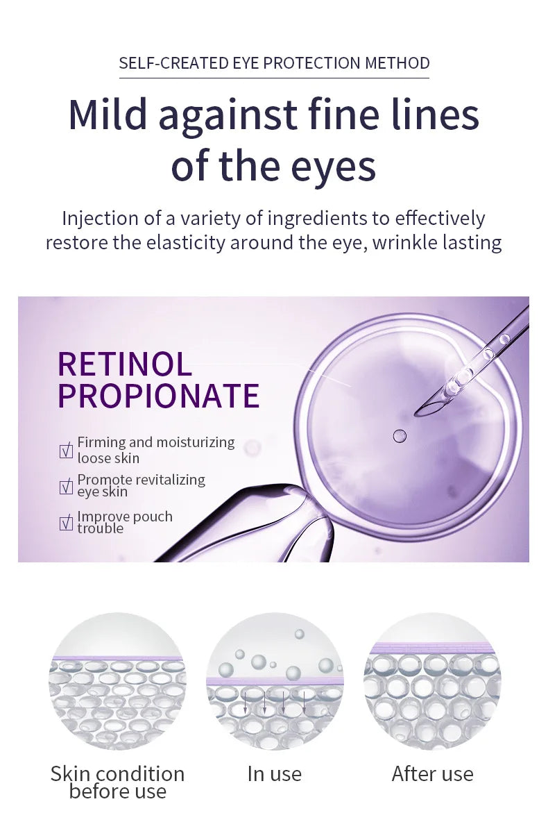 Improve Wrinkle Dark Circle Eye Cream Roller Massager Firming Moisturizing Eye Bags Hyaluronic Acid Eye Skin Care Products