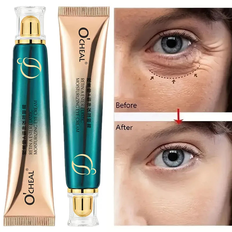 Retinol A Ester Elastic Moisturizing Firming Eye Cream Fading Fine Lines Dark Circles 30g