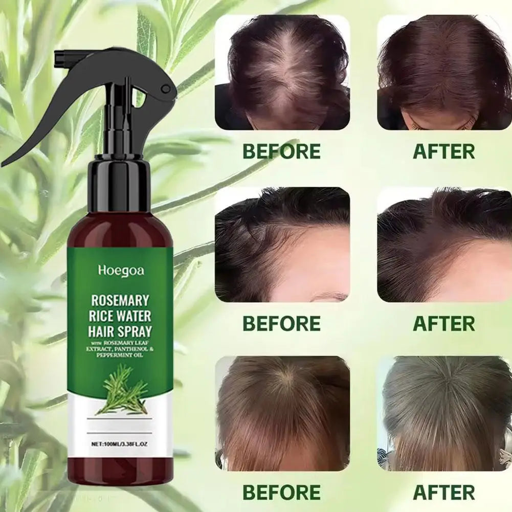 Rosemary Rice Water Hair Growth Spray with Peppermint Biotin Advanced Scalp Treatment for Thinning Hair Regrowth for Men & Women