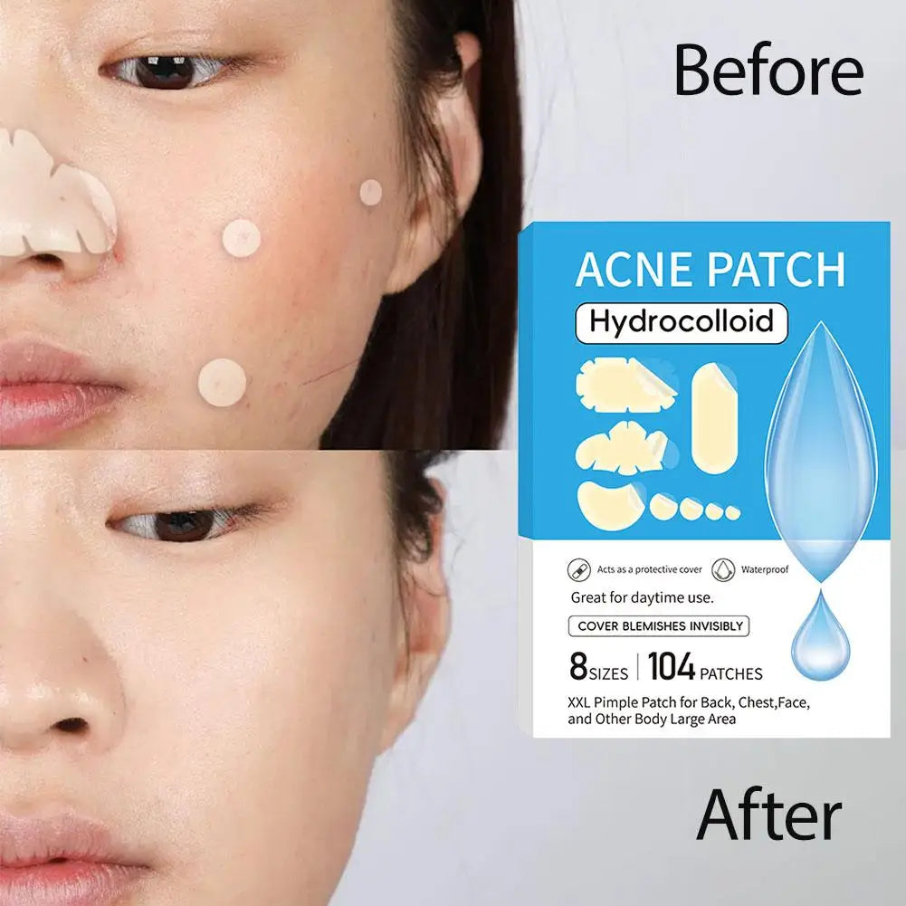 Hydrocolloid acne patch Invisible Pimple Removal Anti-Acne Patches Spots  Gentle Transparent Acne Patch face Skin Care