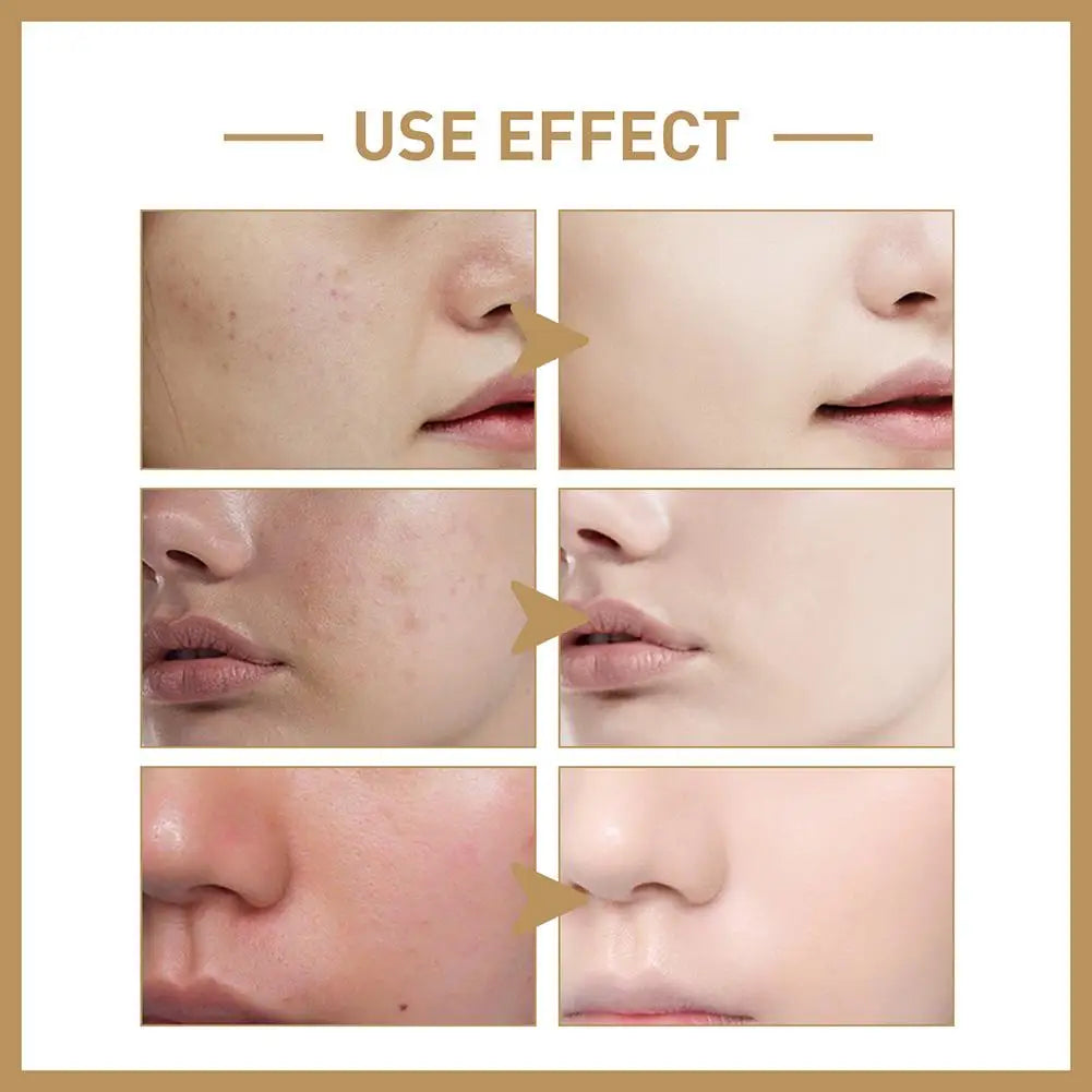 Rice Toner Moisturizing Firming Skin Soothing Repairing Skin Barrier Nicotinamide Brightening Rice Facial Toner Skin Care