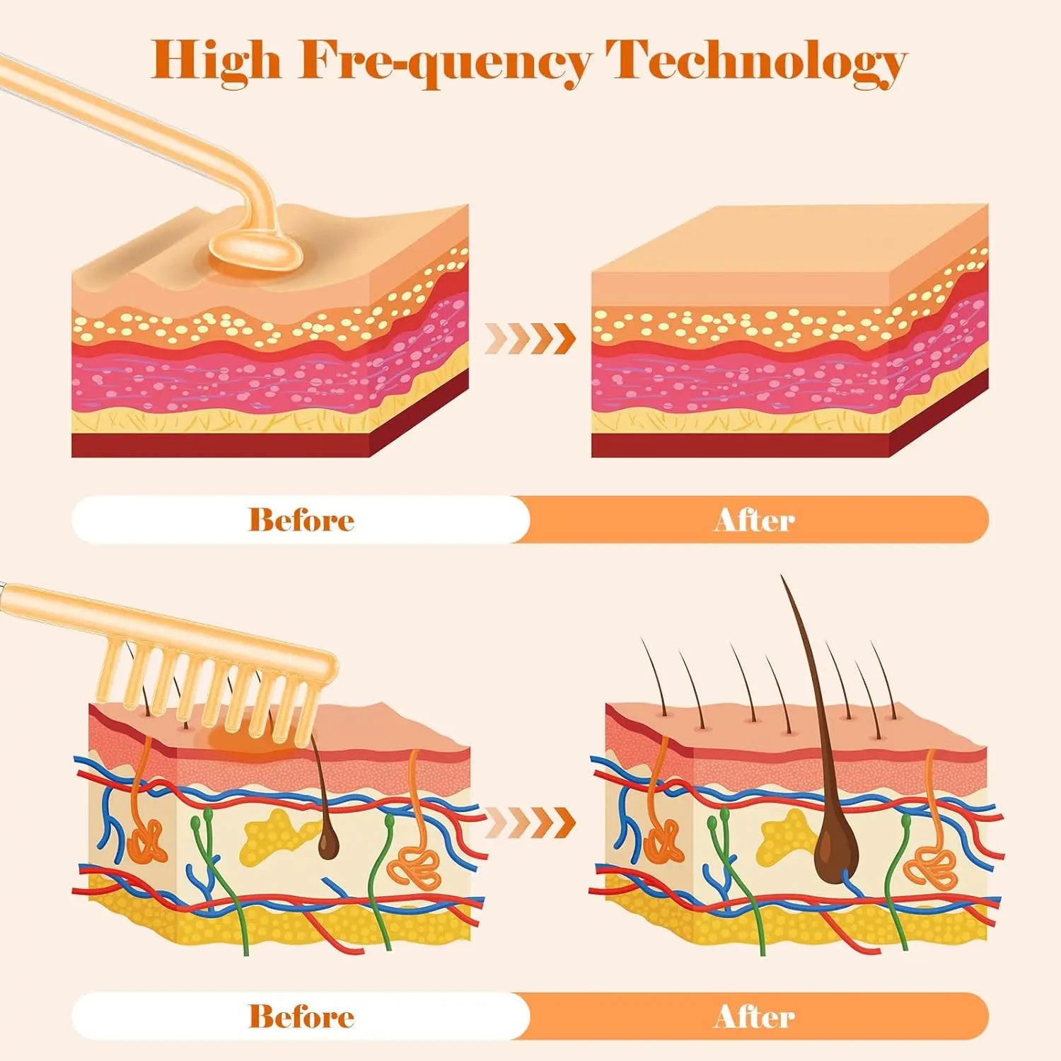 7 in 1 High Frequency Beauty Machine/ Professional Portable Handheld High Frequency Facial Skin Beauty Machine