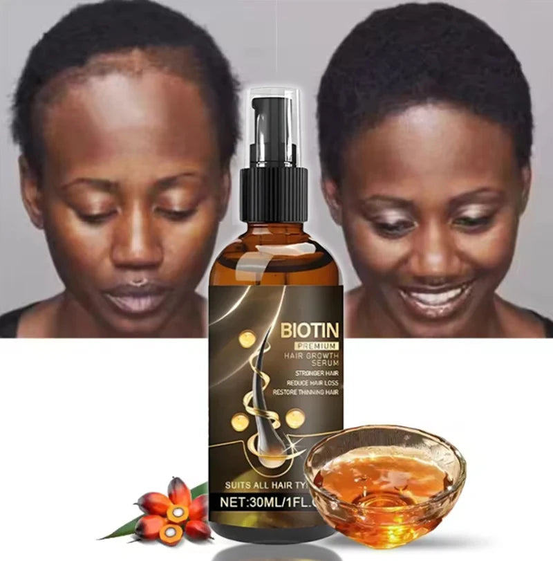 Anti-Hair Loss Essence Serum Promotes Hair Growth Improves Scalp Environment Hair Care